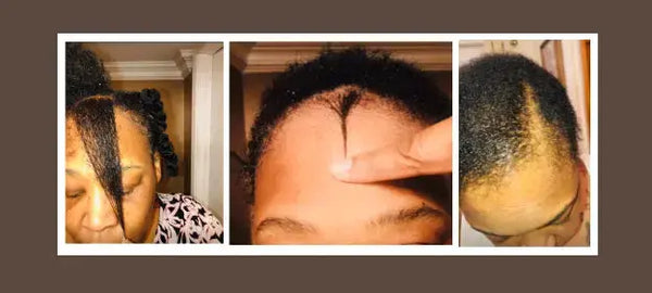 Lets Be Honest About Hair Growth!